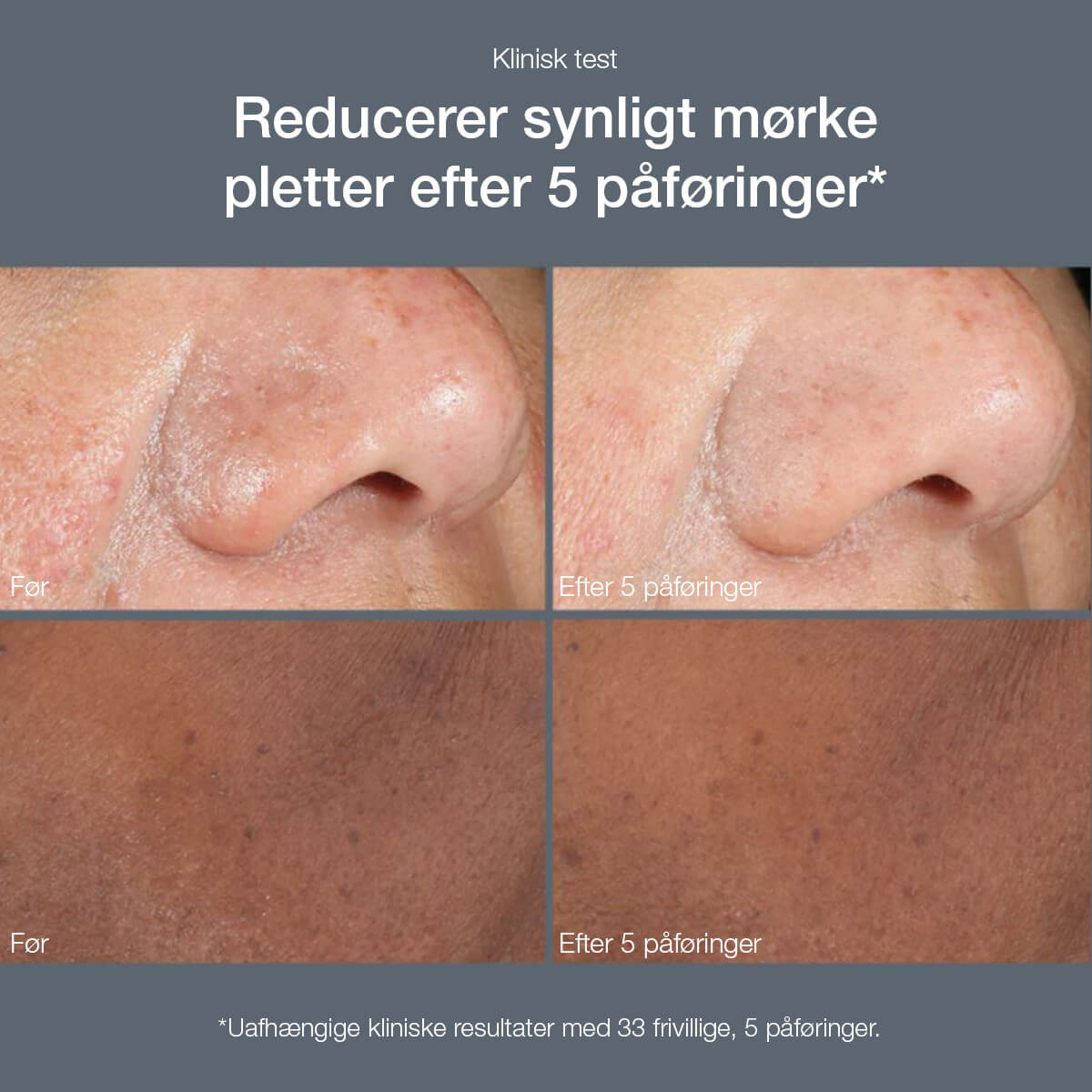 powerbright dark spot peel