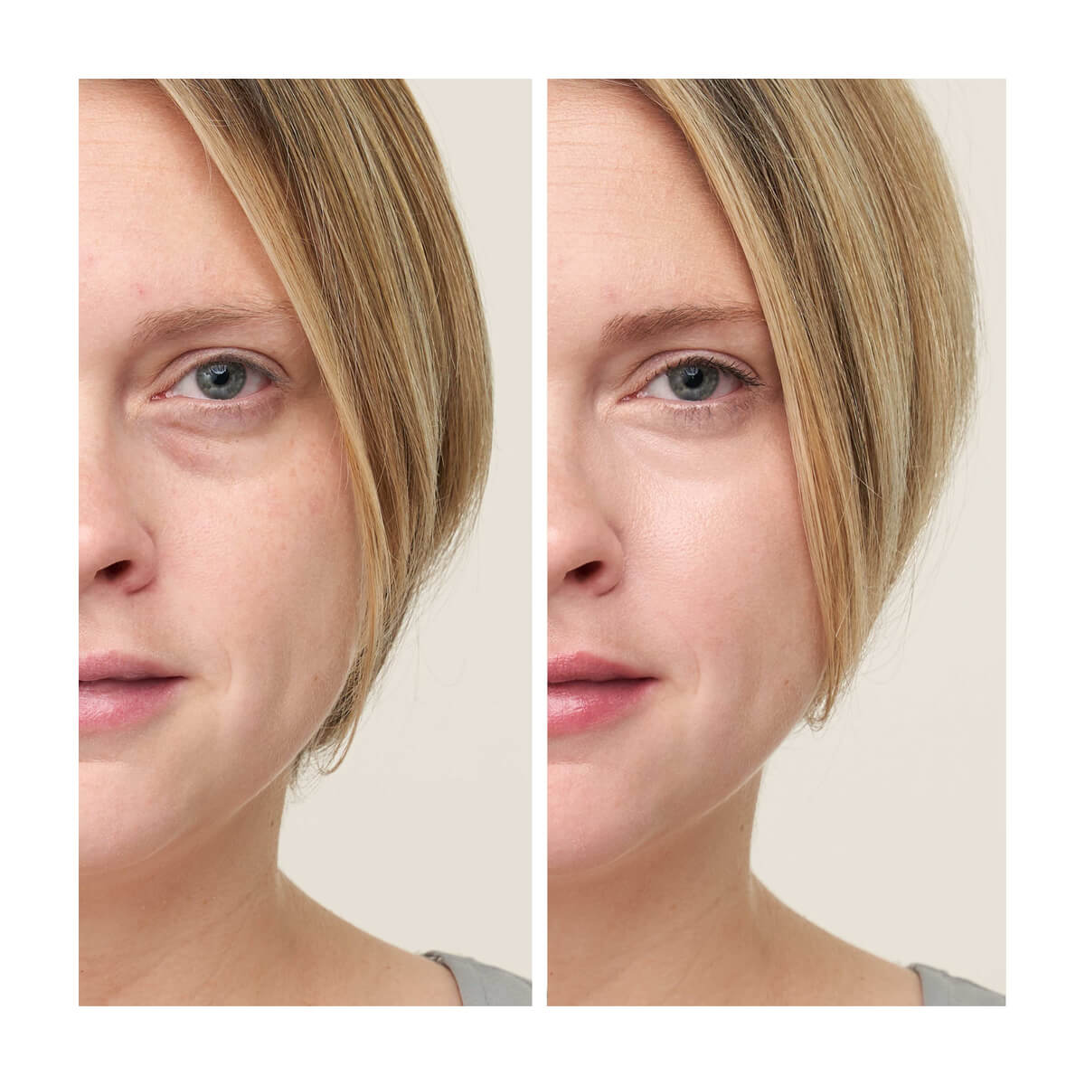 Circle\Delete® Concealer