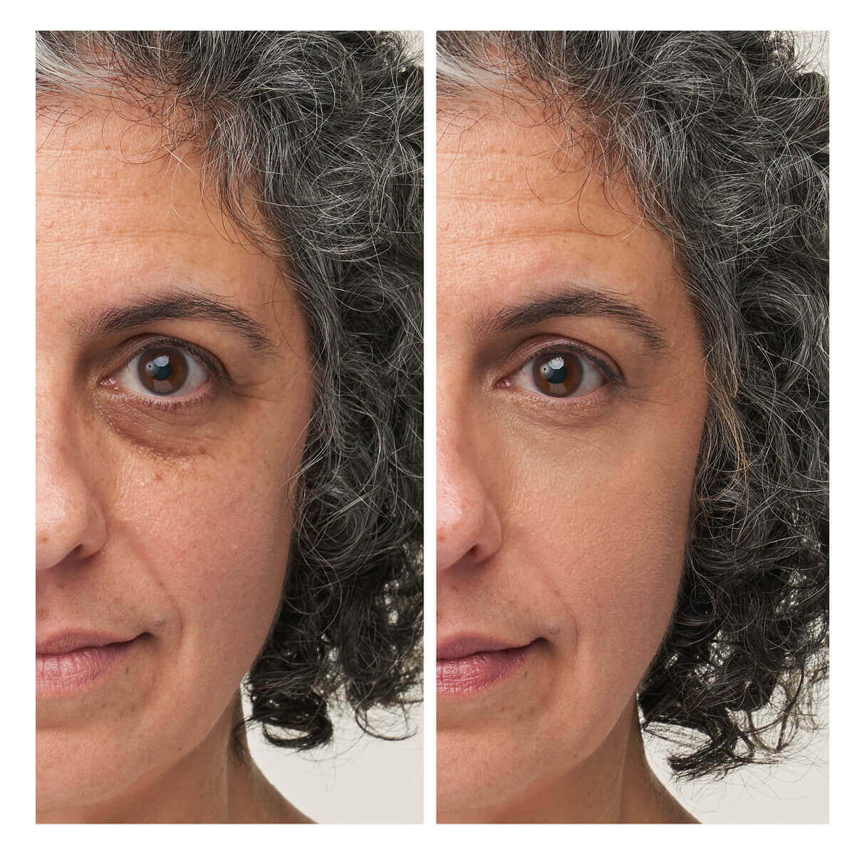 Enlighten Plus™ Under-eye Concealer