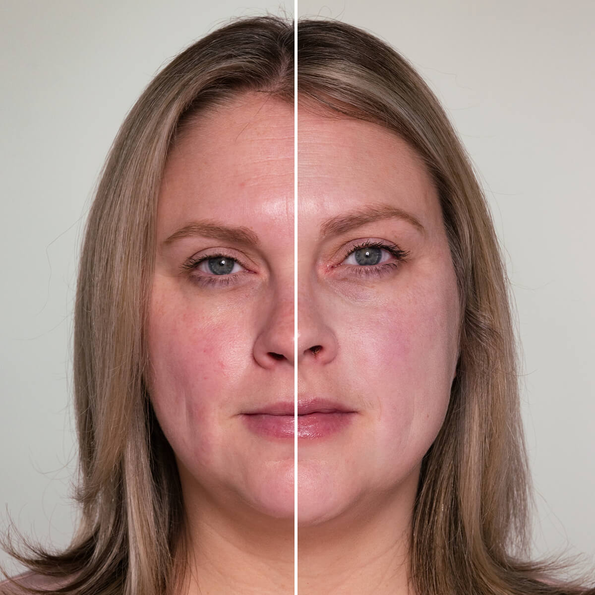 HydroPure™ Color Correcting Serum with Hyaluronic Acid & CoQ10